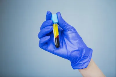 Membrana de plasma rico en plaquetas y factores de crecimiento