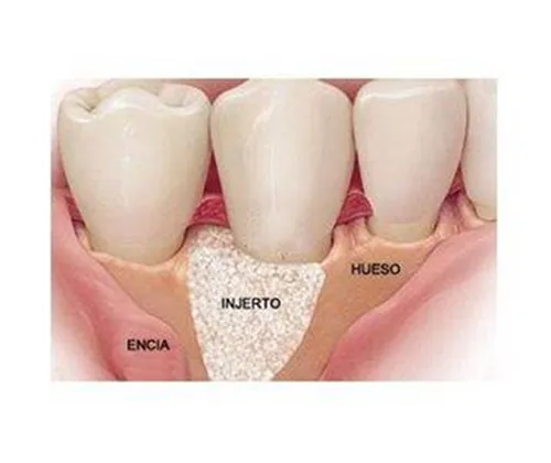 Cirugía oral