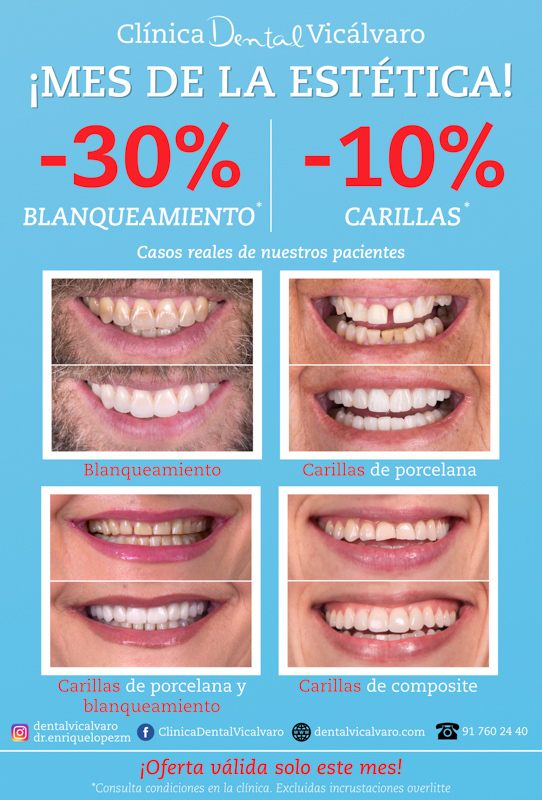 ¡ Mes de la estética !