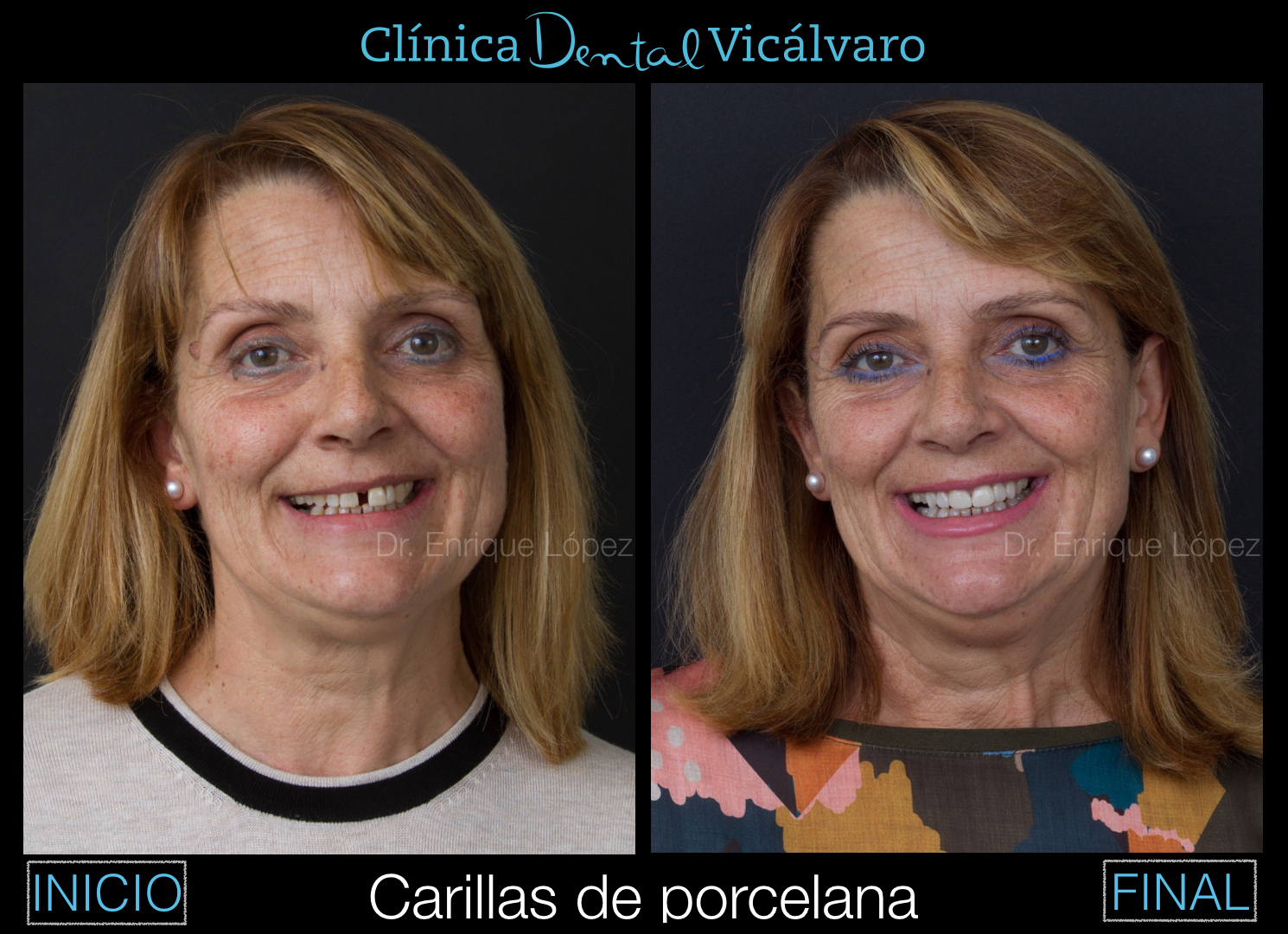 Foto comparativa 1