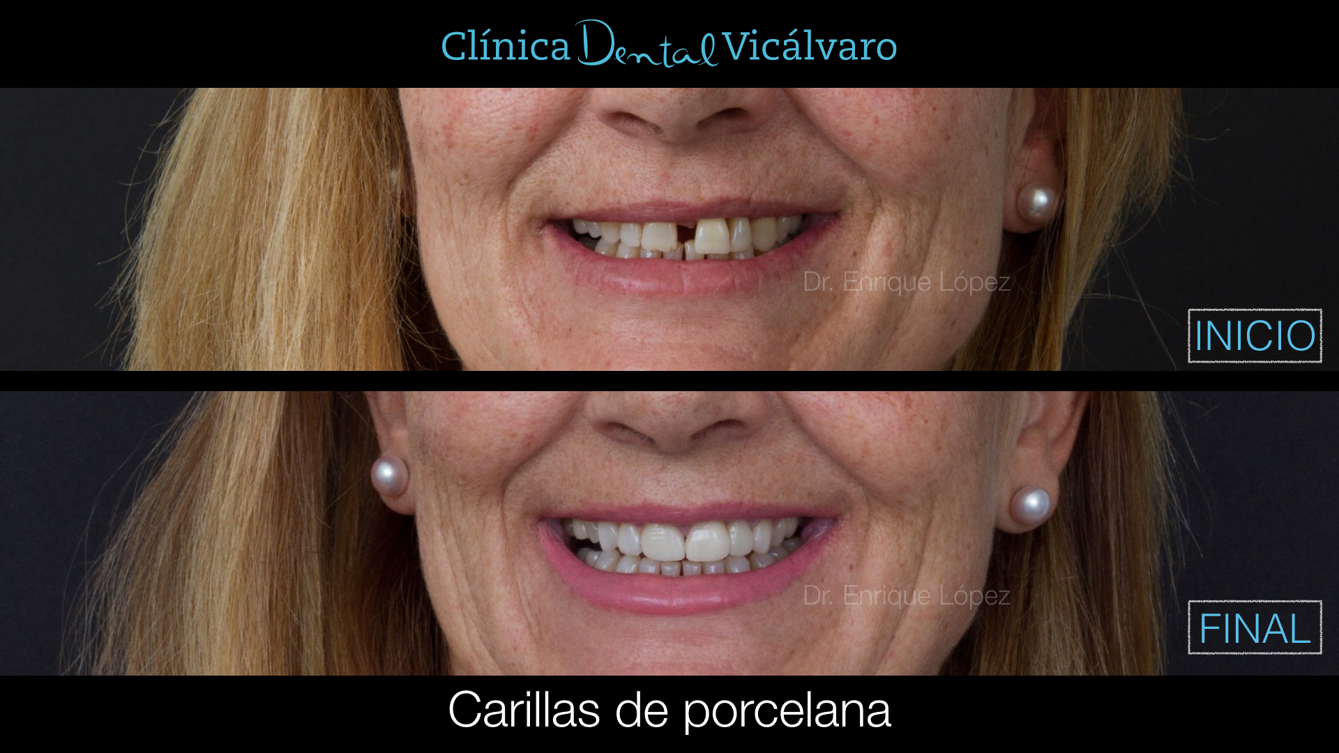 Foto comparativa 2