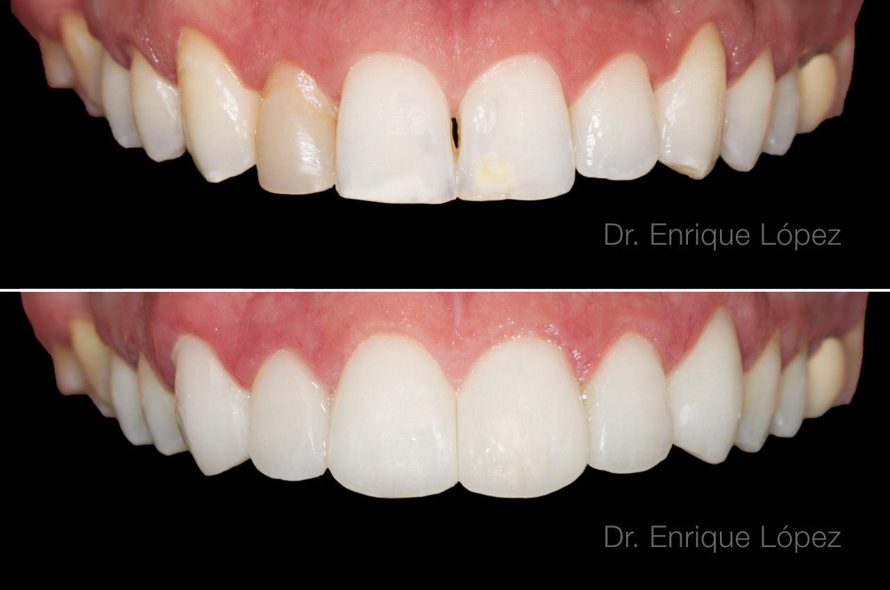 Foto comparativa 2
