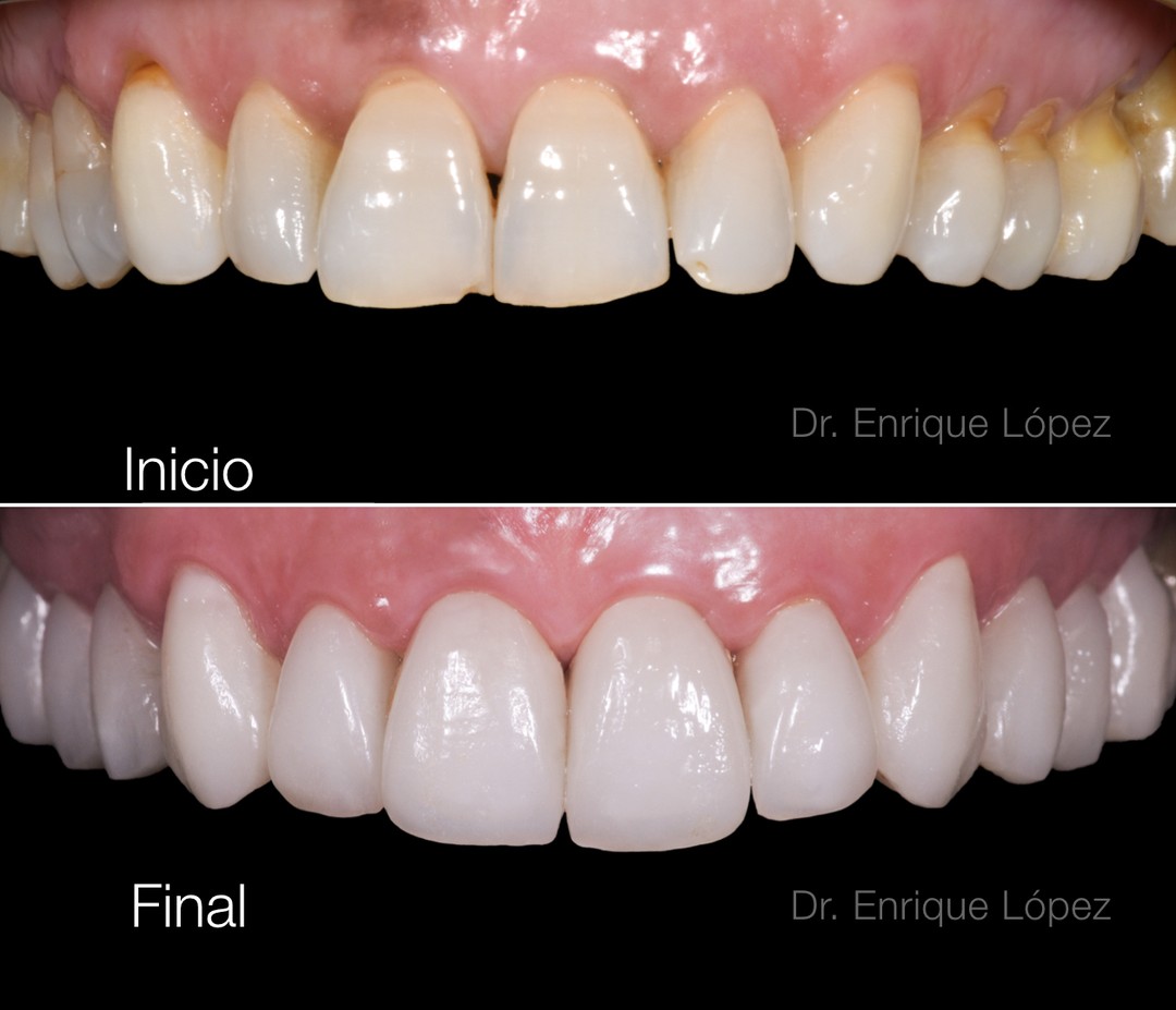 Foto comparativa 1