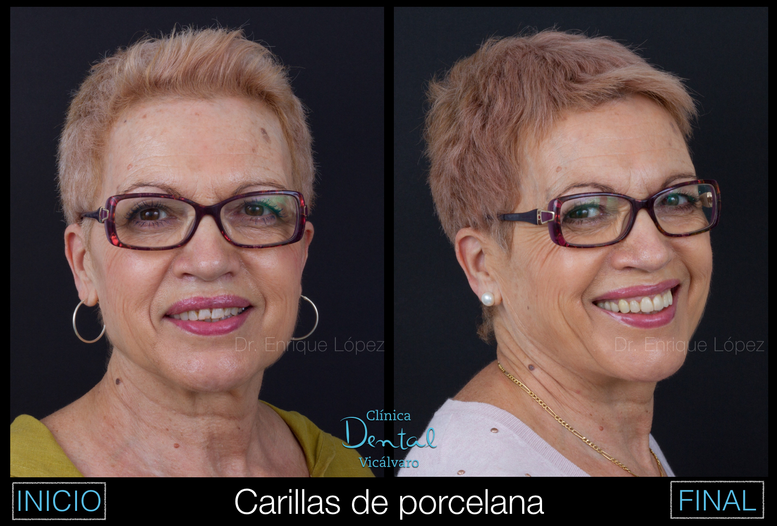 Foto comparativa 2