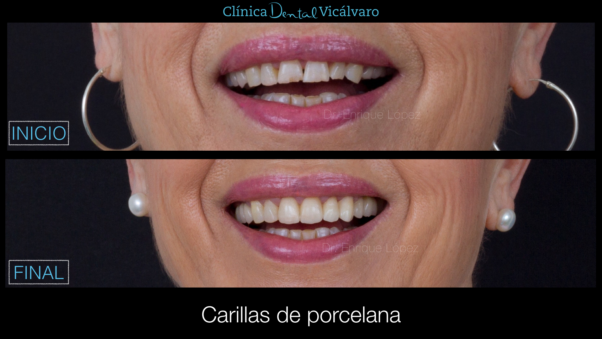 Foto comparativa 3