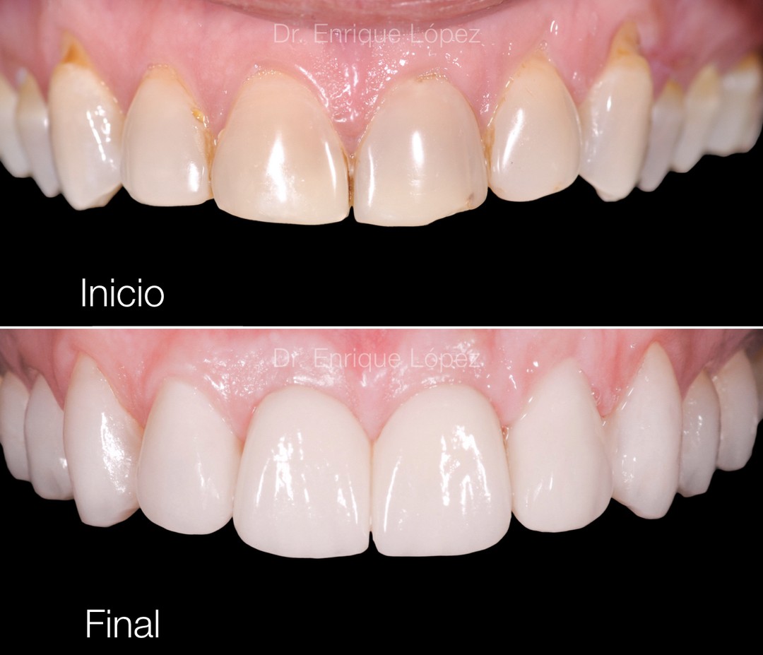 Foto comparativa 1