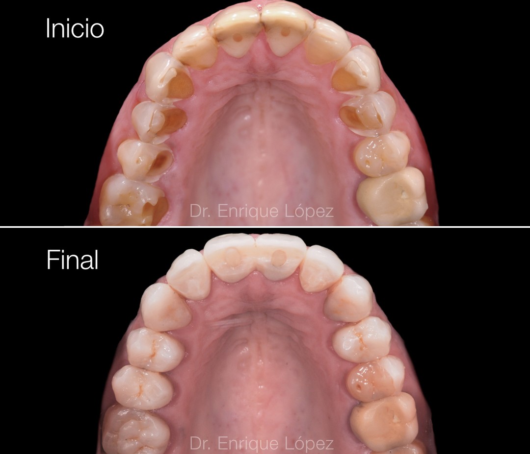 Foto comparativa 3