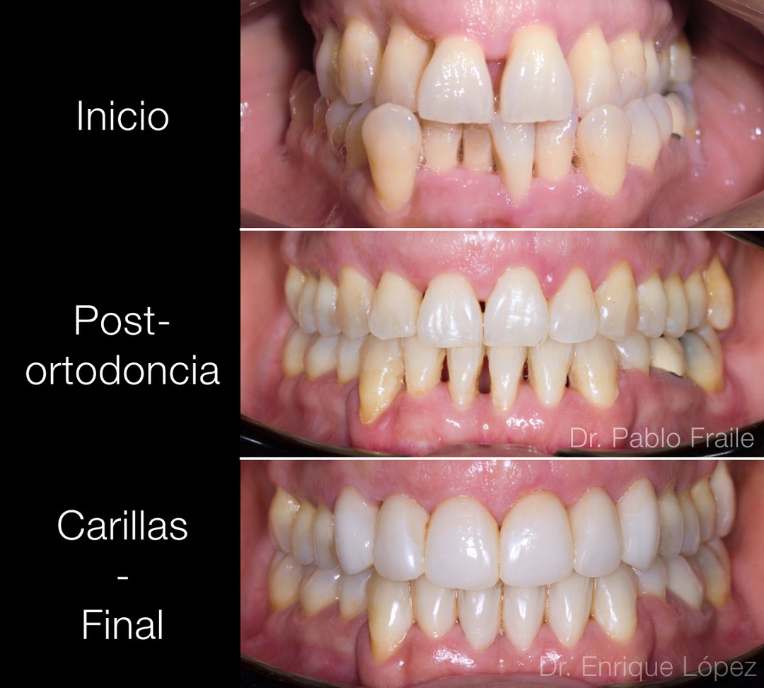 Foto comparativa 2
