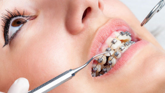 Ortodoncia y ortopedia dental