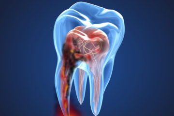 Endodoncia y odontología conservadora