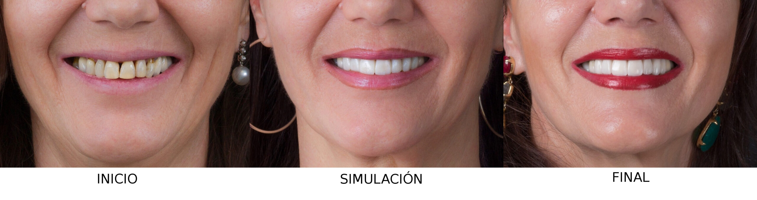 Simulación DSD