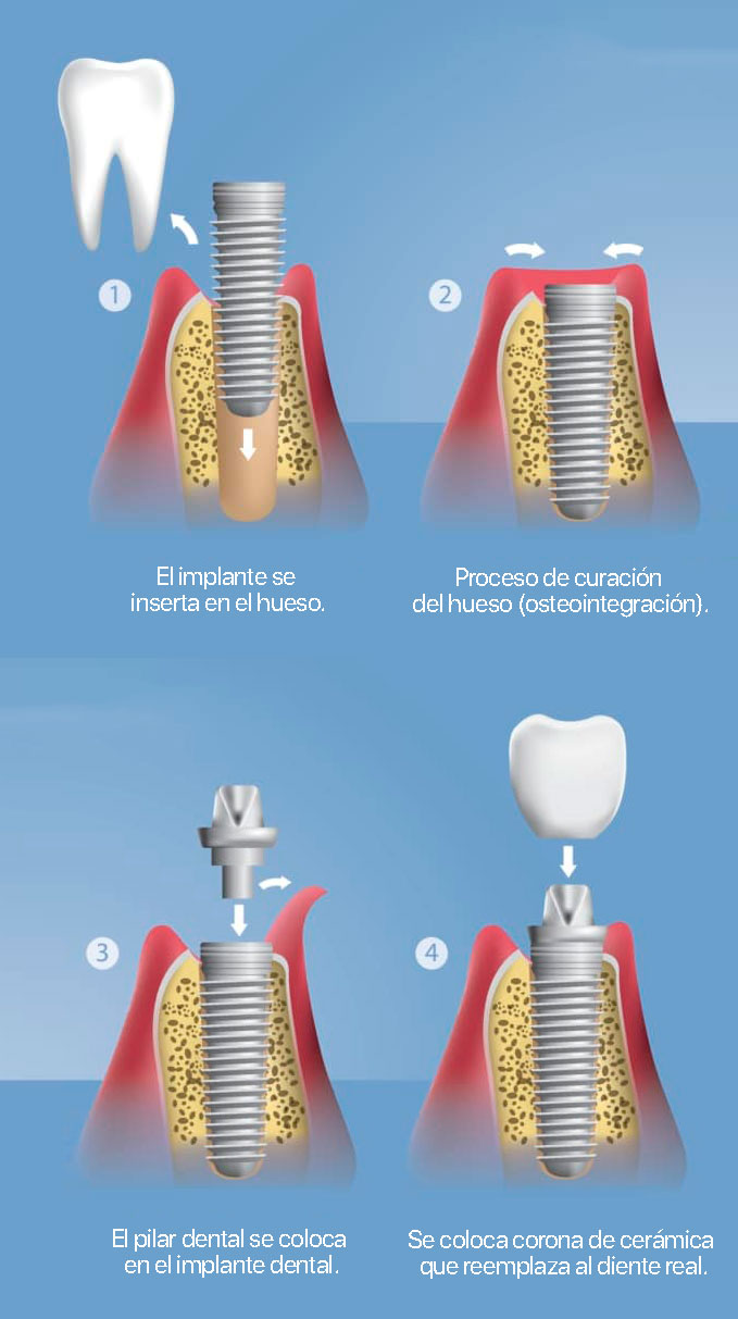 Proceso estándar